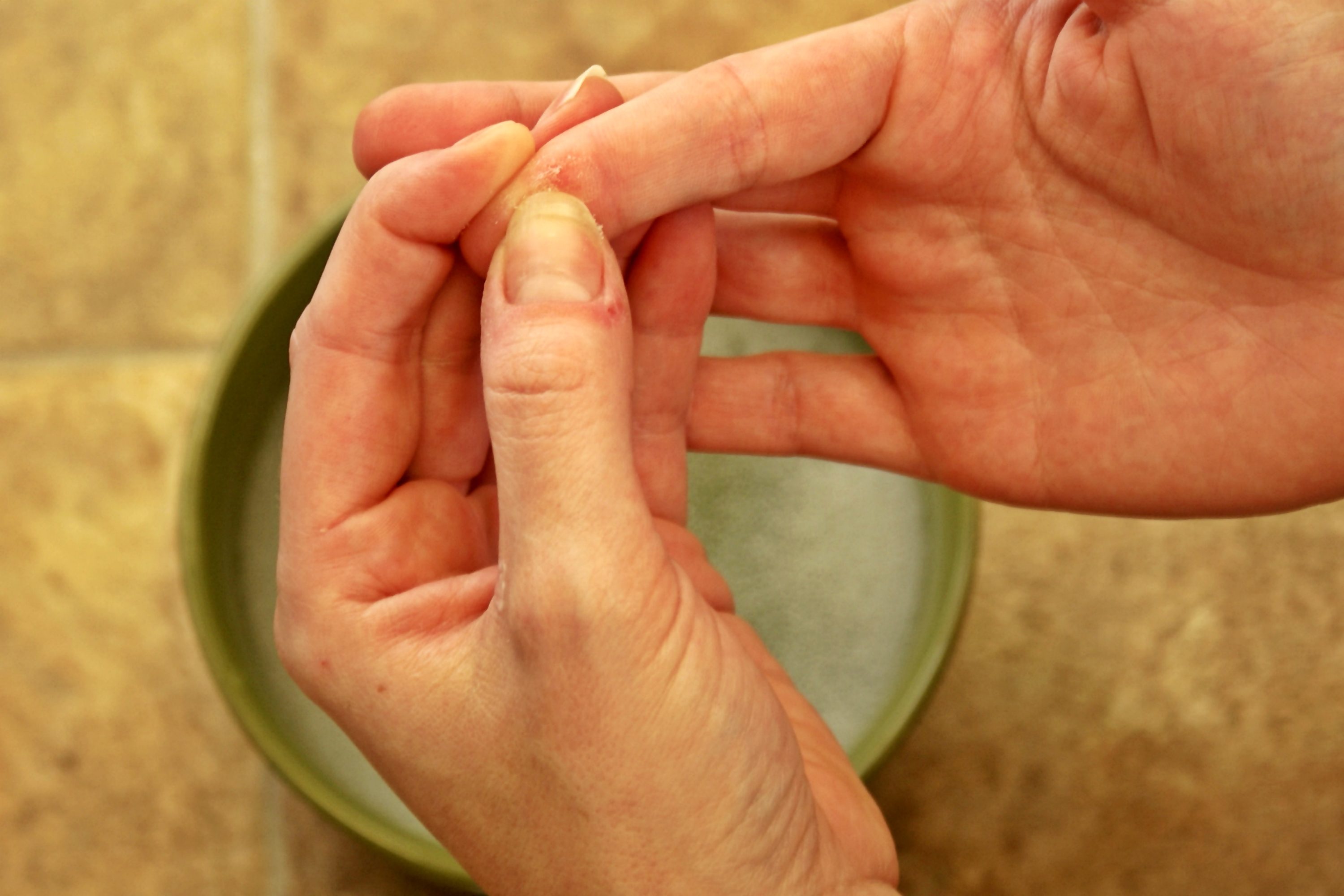 How To Remove The Moment Glue From The Hands Than To Wash At